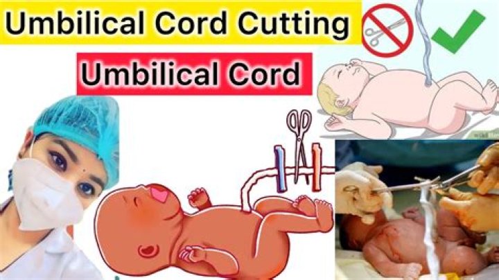 Can my husband cut the umbilical cord during C section?